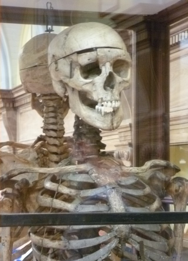 William_Burke's_skeleton
